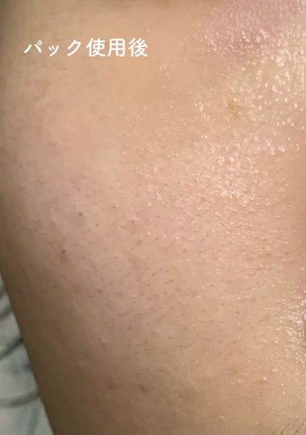 ダーマレーザースーパーVC100マスク/クオリティファースト/シートマスク・パックを使ったクチコミ(8枚目)