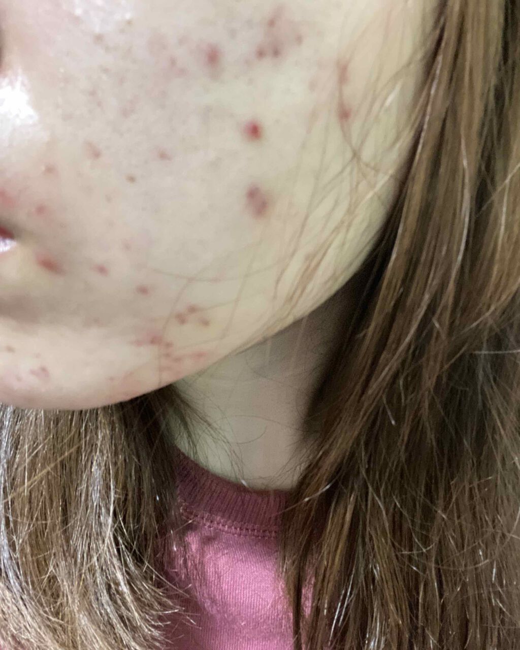 モイスチャー クリアソープ/アルージェ/洗顔石鹸を使ったクチコミ（3枚目）