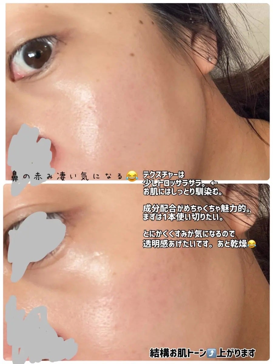 ohhhte on LIPS 「@medicube_japan#メディキューブ様より新アイテム..」(4枚目)