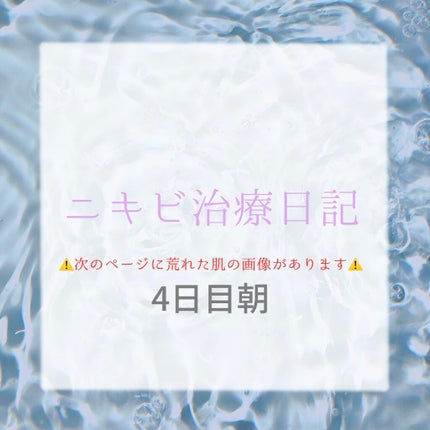 デュアック配合ゲル/ポーラファルマ/その他を使ったクチコミ(1枚目)