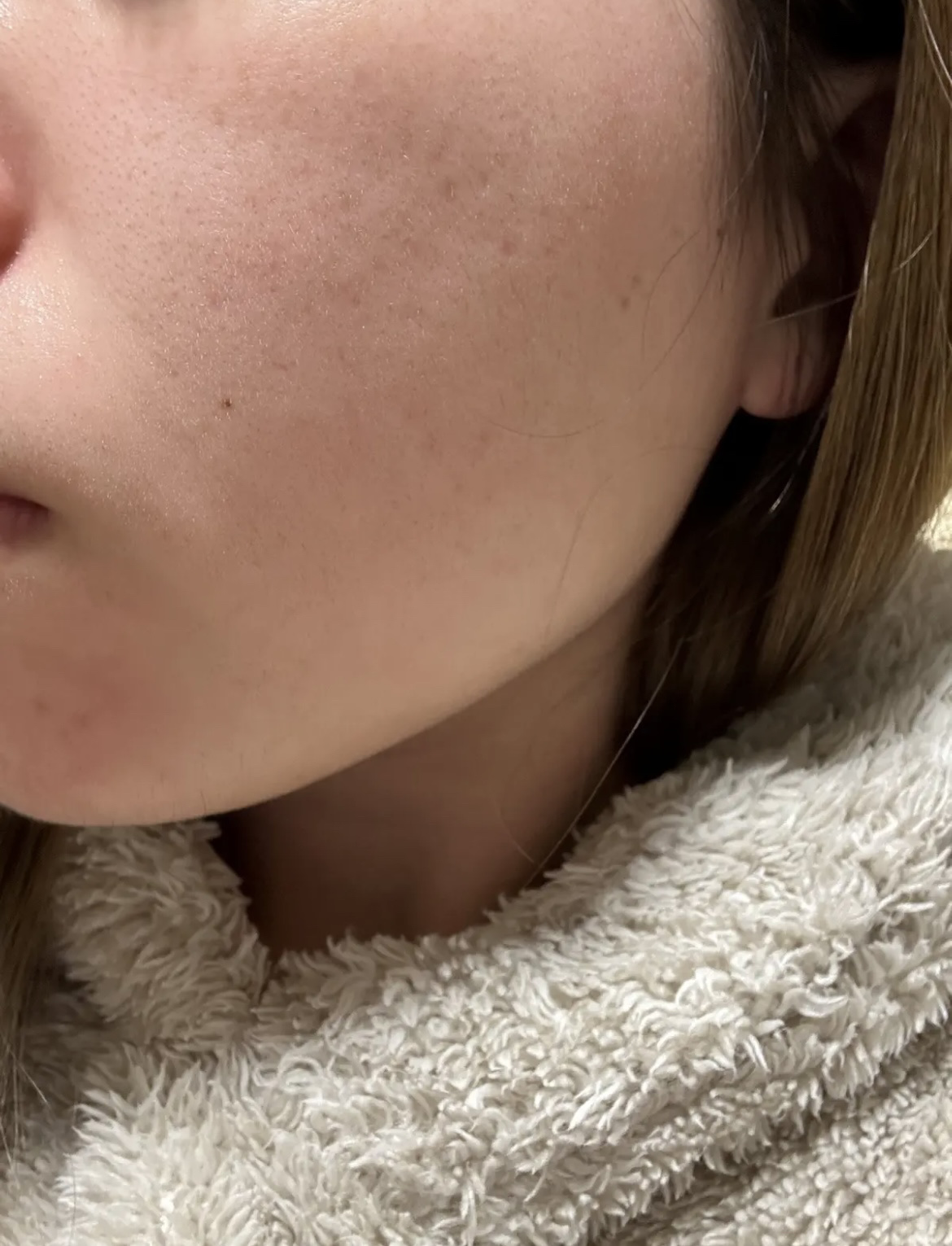 THE N.M.F APマスクJEX/MEDIHEAL/シートマスク・パックを使ったクチコミ（3枚目）