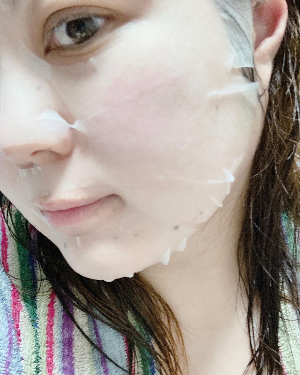 ハイポアレジェニックシカアンプル/Dermatory/美容液を使ったクチコミ(8枚目)