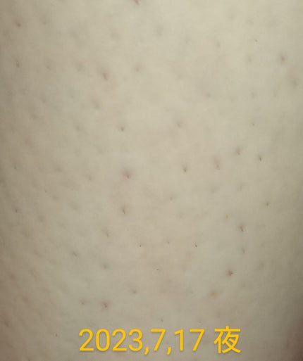 S.S.C. EPI PHOTO SKIN CARE PRO 家庭用光美容器 / ミュゼコスメ S.S.C. EPI PHOTO SKIN CARE PRO 家庭用光美容器 / ミュゼコスメ