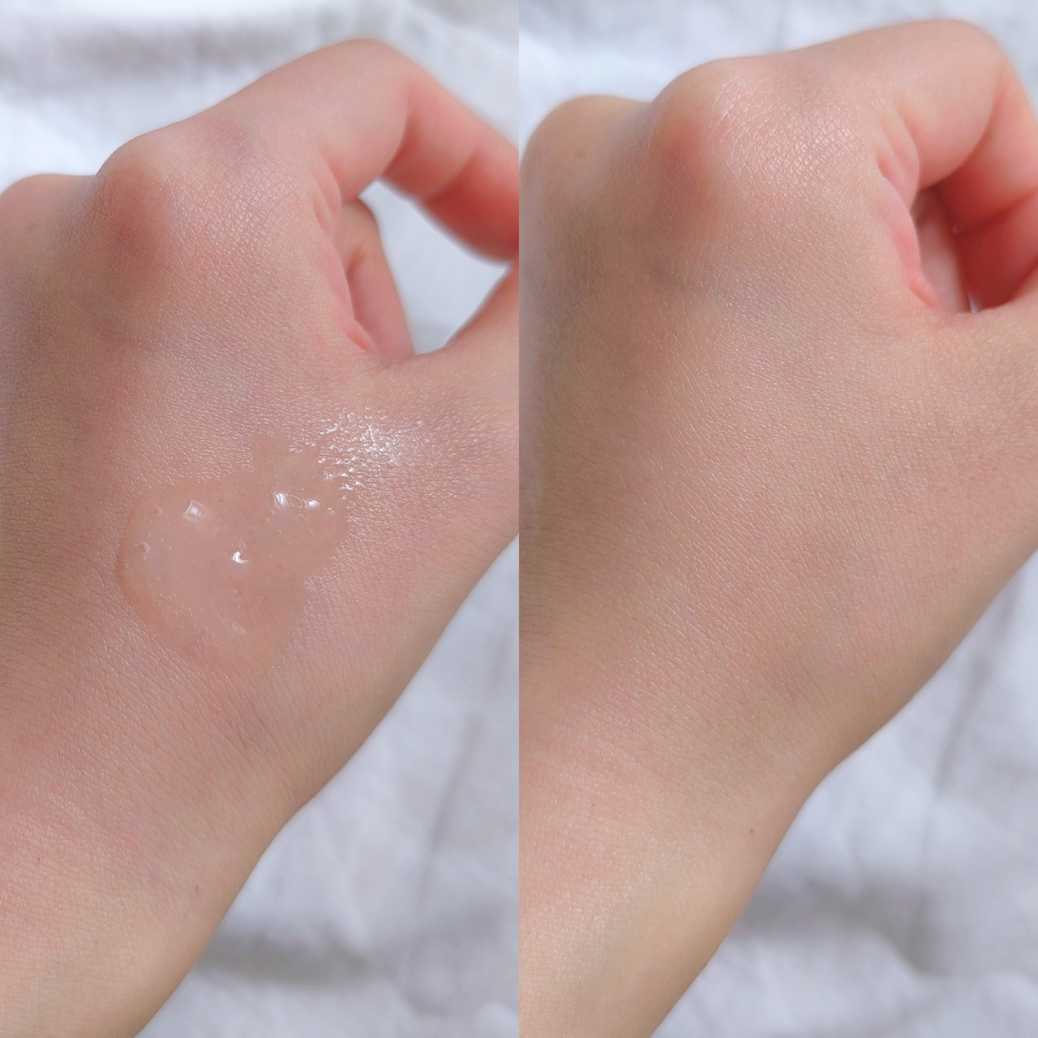 アルティミューン™ パワライジング セラム/SHISEIDO/美容液を使ったクチコミ（3枚目）