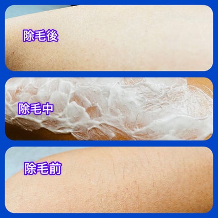 NONON/NONON(ノンノン)/除毛クリームを使ったクチコミ(4枚目)