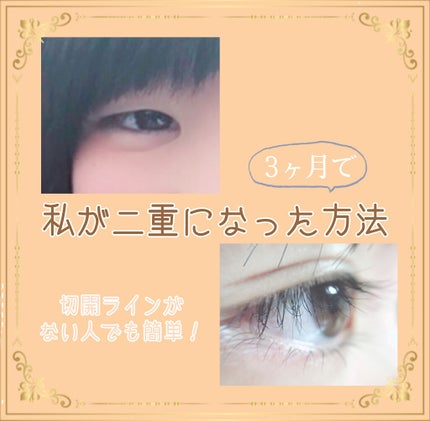 アイビューティー フィクサー WP/アストレア ヴィルゴ/二重まぶた用アイテムを使ったクチコミ(1枚目)