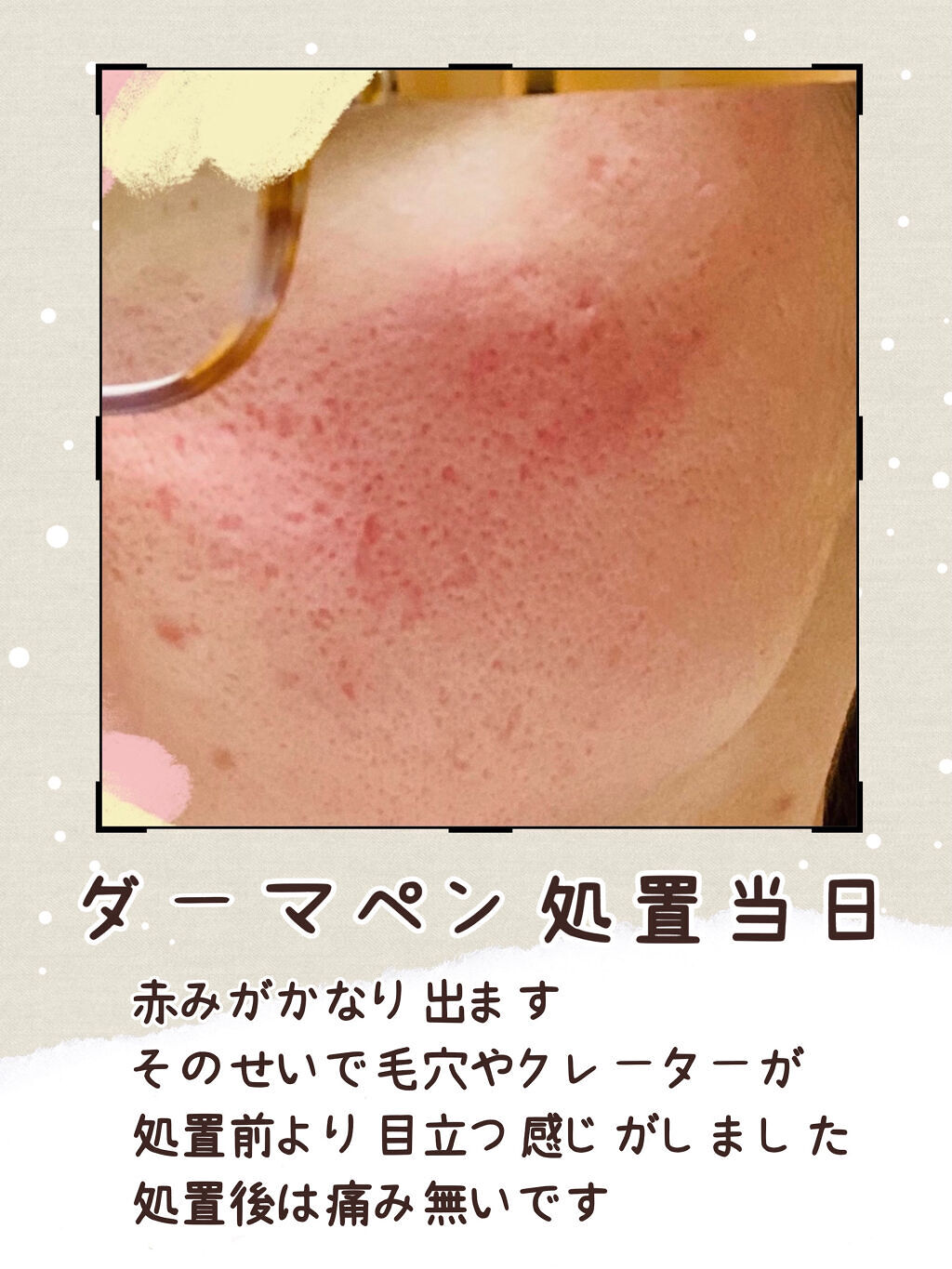 を使ったクチコミ（3枚目）