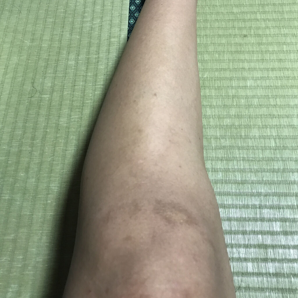 寝ながらメディキュット ロング/メディキュット/着圧ソックス・レギンスを使ったクチコミ（3枚目）