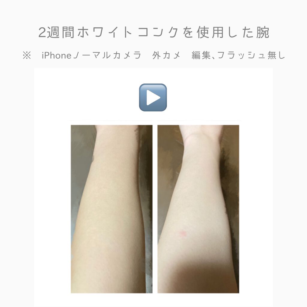 薬用ホワイトコンク ボディシャンプーC II/ホワイトコンク/ボディソープを使ったクチコミ(2枚目)