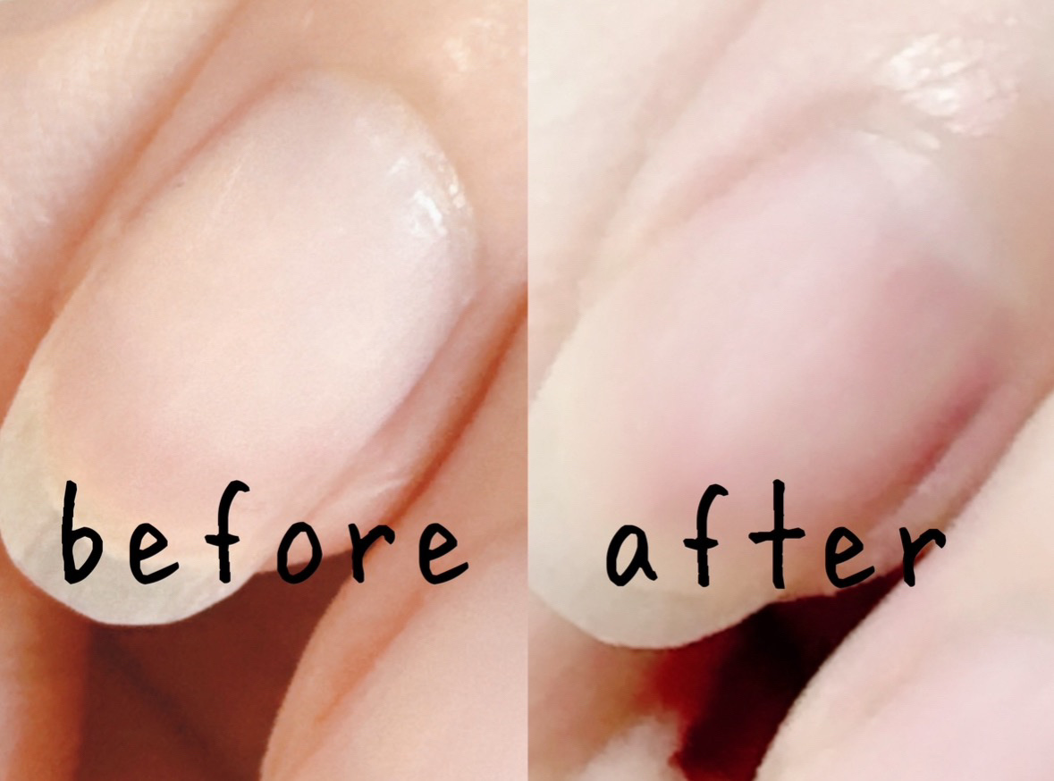 キューティクルスクレイパー スリム/デュカート/ネイル用品を使ったクチコミ（2枚目）