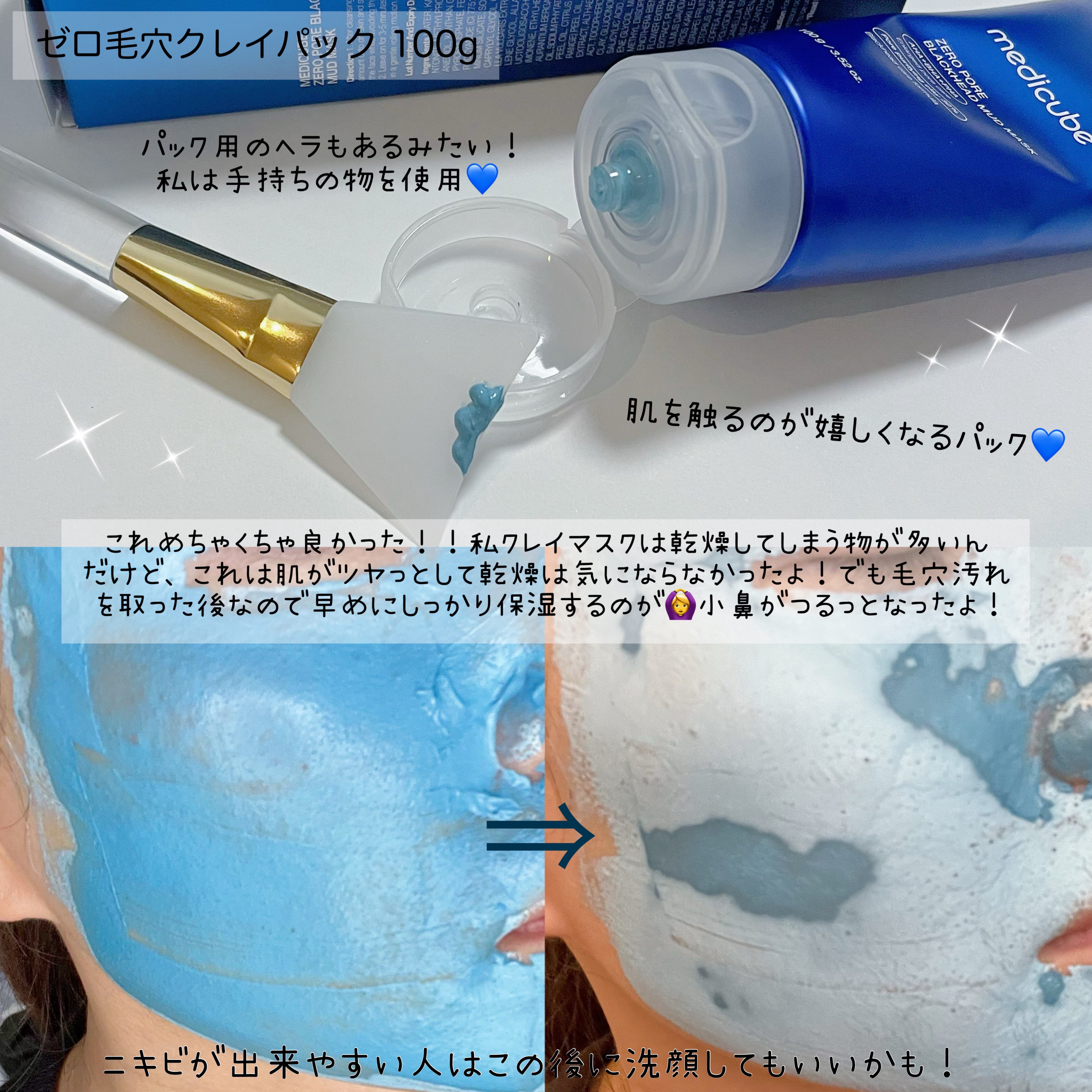 ゼロ毛穴パッド 2.0/MEDICUBE/トナーパッドを使ったクチコミ（3枚目）