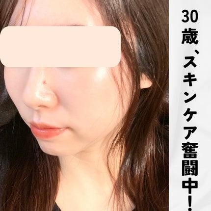 オルビスユー デイエッセンス/オルビス/美容液を使ったクチコミ(1枚目)