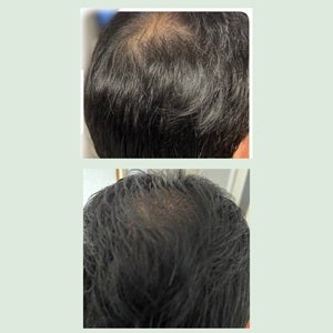 SonoRepro/アンファー(スカルプD)/ヘアケアグッズを使ったクチコミ(4枚目)