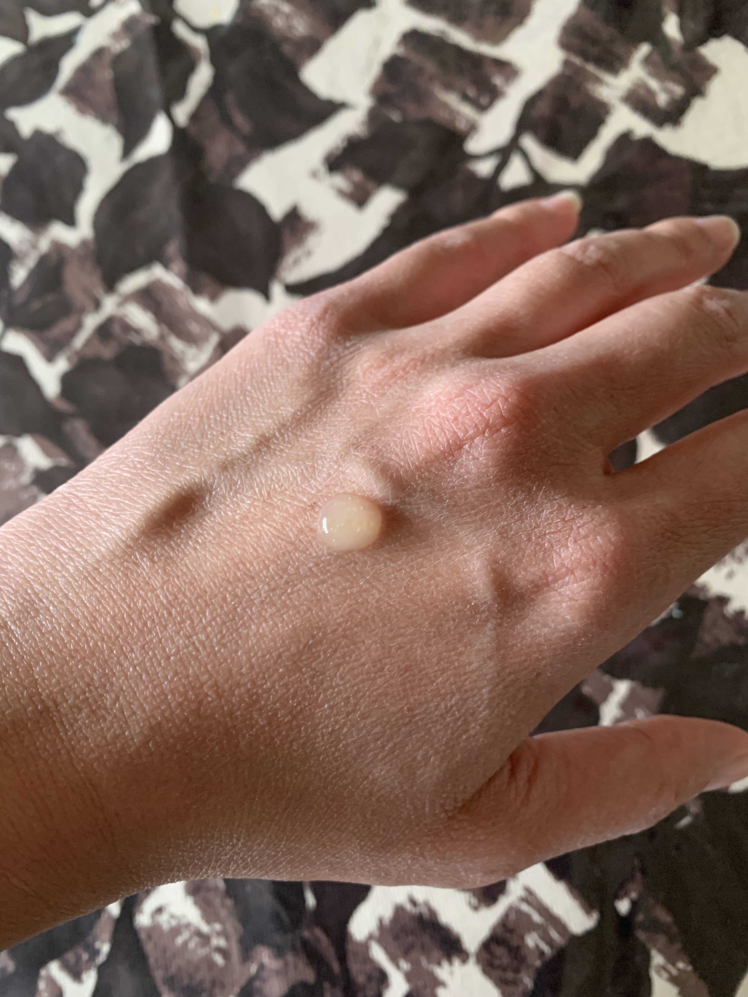 レチノコラーゲン低分子300パンピングアンプル/CKD/美容液を使ったクチコミ（2枚目）