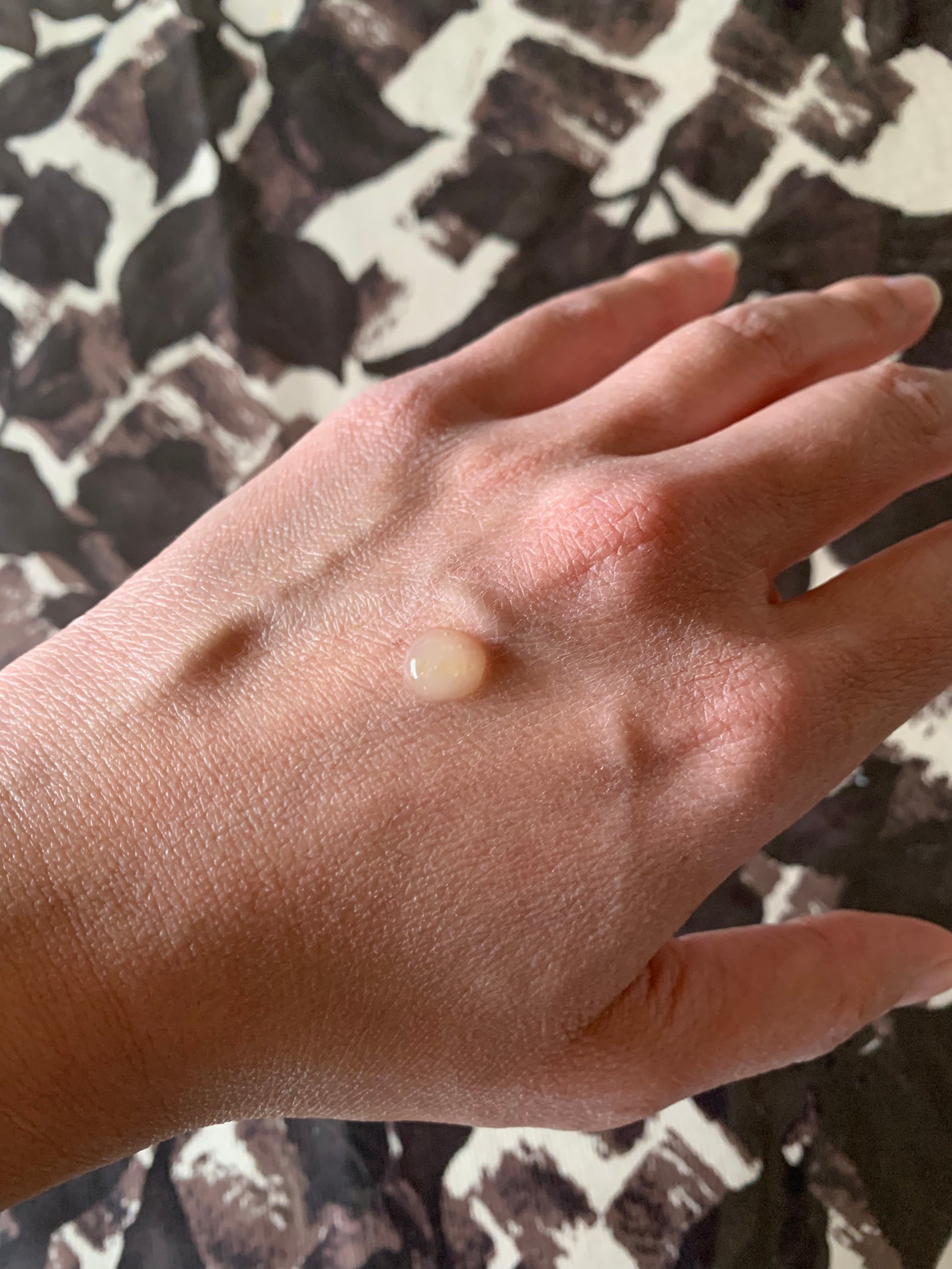 レチノコラーゲン低分子300パンピングアンプル/CKD/美容液を使ったクチコミ(2枚目)