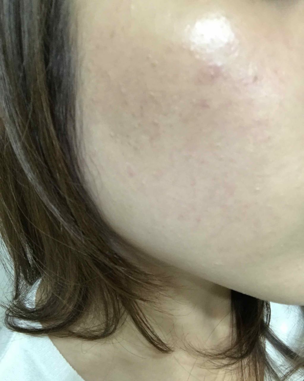 アレルバリア エッセンス BB/d プログラム/BBクリームを使ったクチコミ(4枚目)