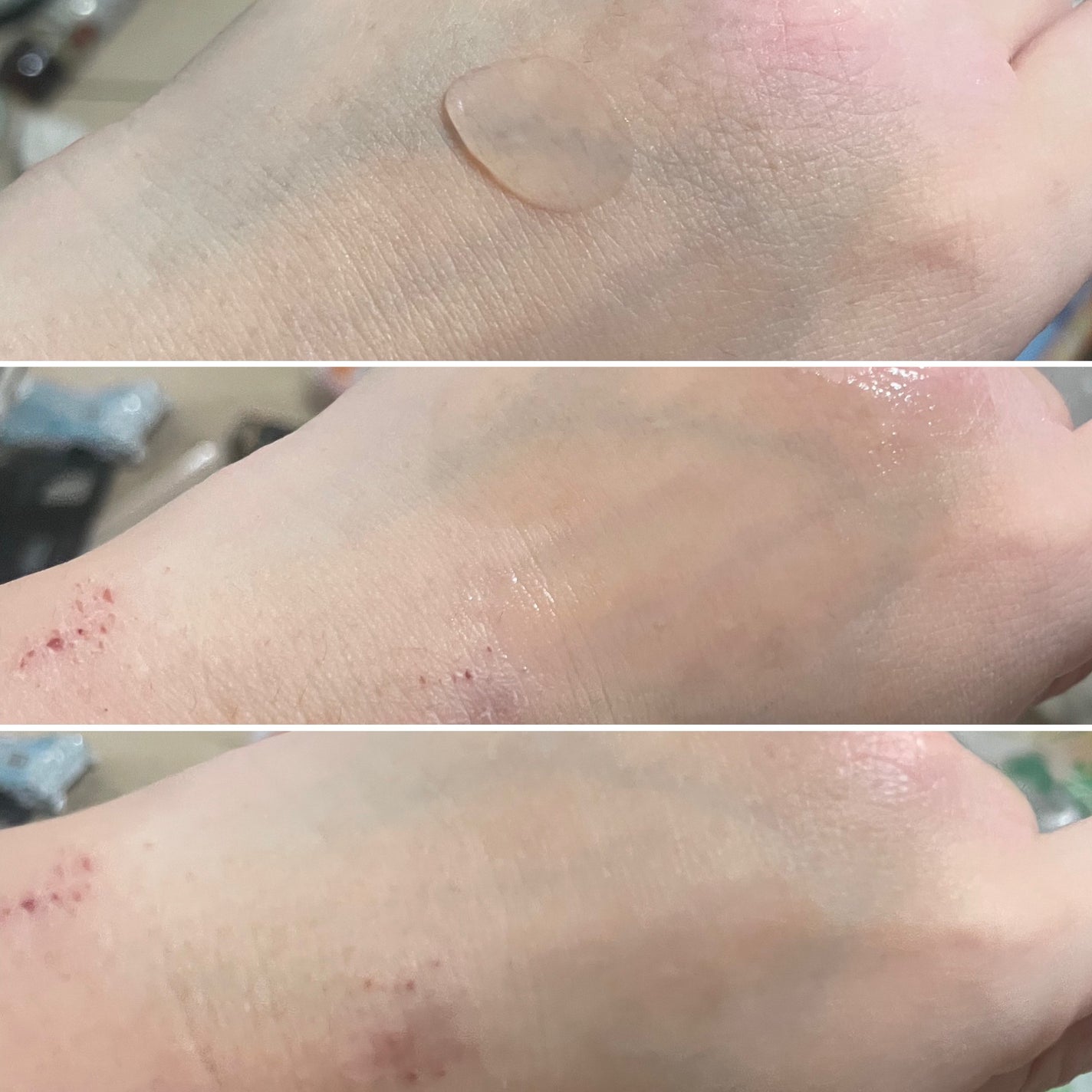 オイデルミン エッセンスローション/SHISEIDO/化粧水を使ったクチコミ(3枚目)