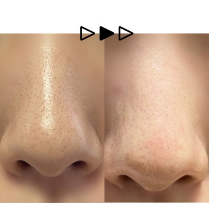 ノーモアブラックヘッド(ノーズピーリング)/One-day's you/スクラブ・ゴマージュを使ったクチコミ(2枚目)