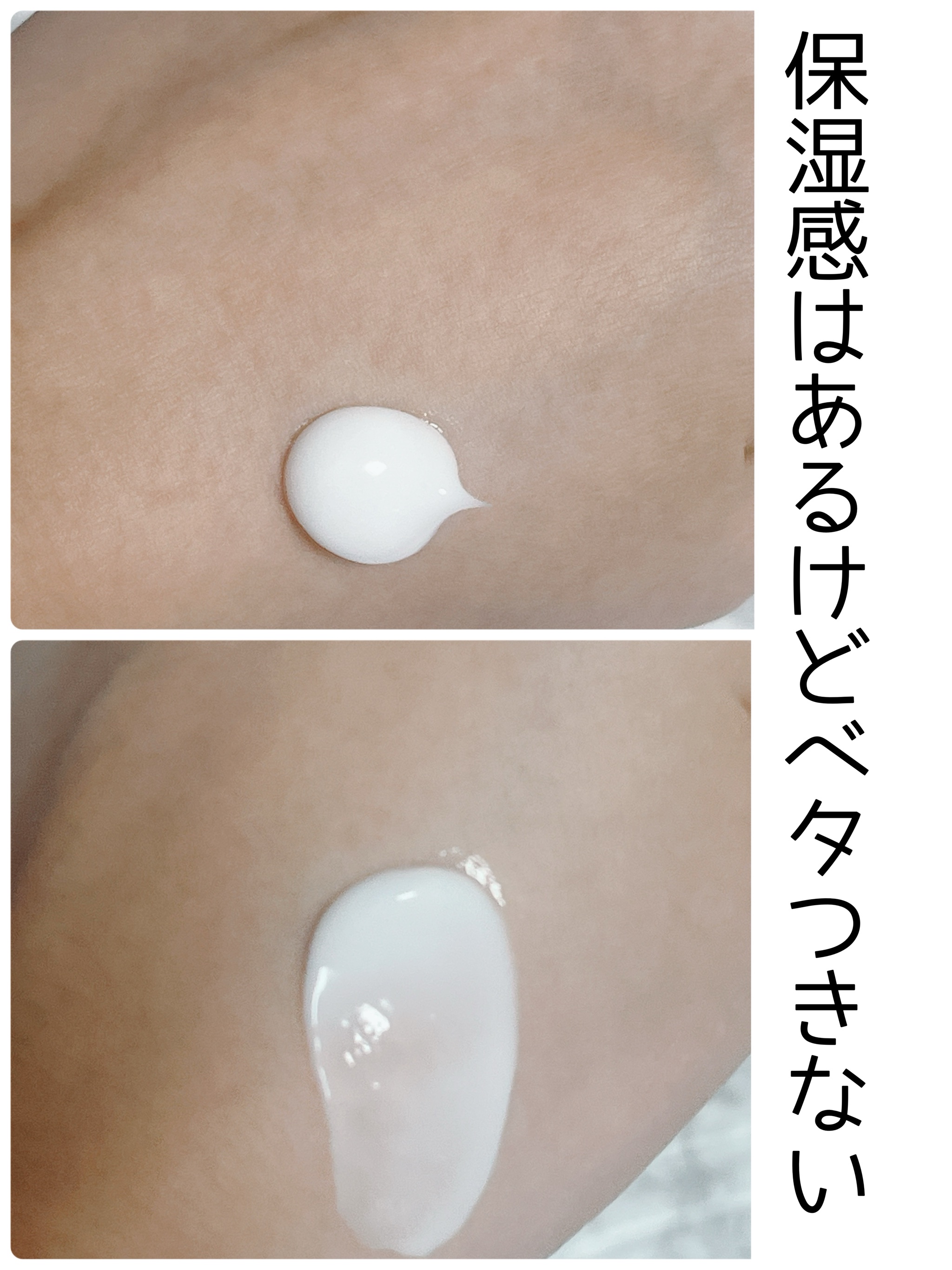 マデセルダーマ リペア B5 クリーム/theralogic/フェイスクリームを使ったクチコミ（2枚目）