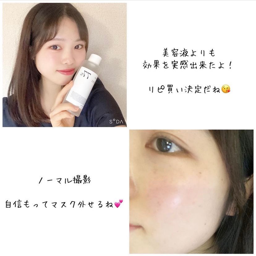 ドクダミ 77 スージングトナー/Anua/化粧水を使ったクチコミ(5枚目)