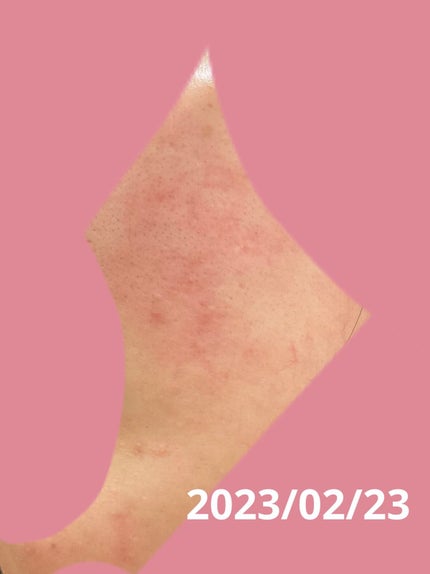 薬用しみ対策 美白化粧水/メラノCC/化粧水を使ったクチコミ(2枚目)