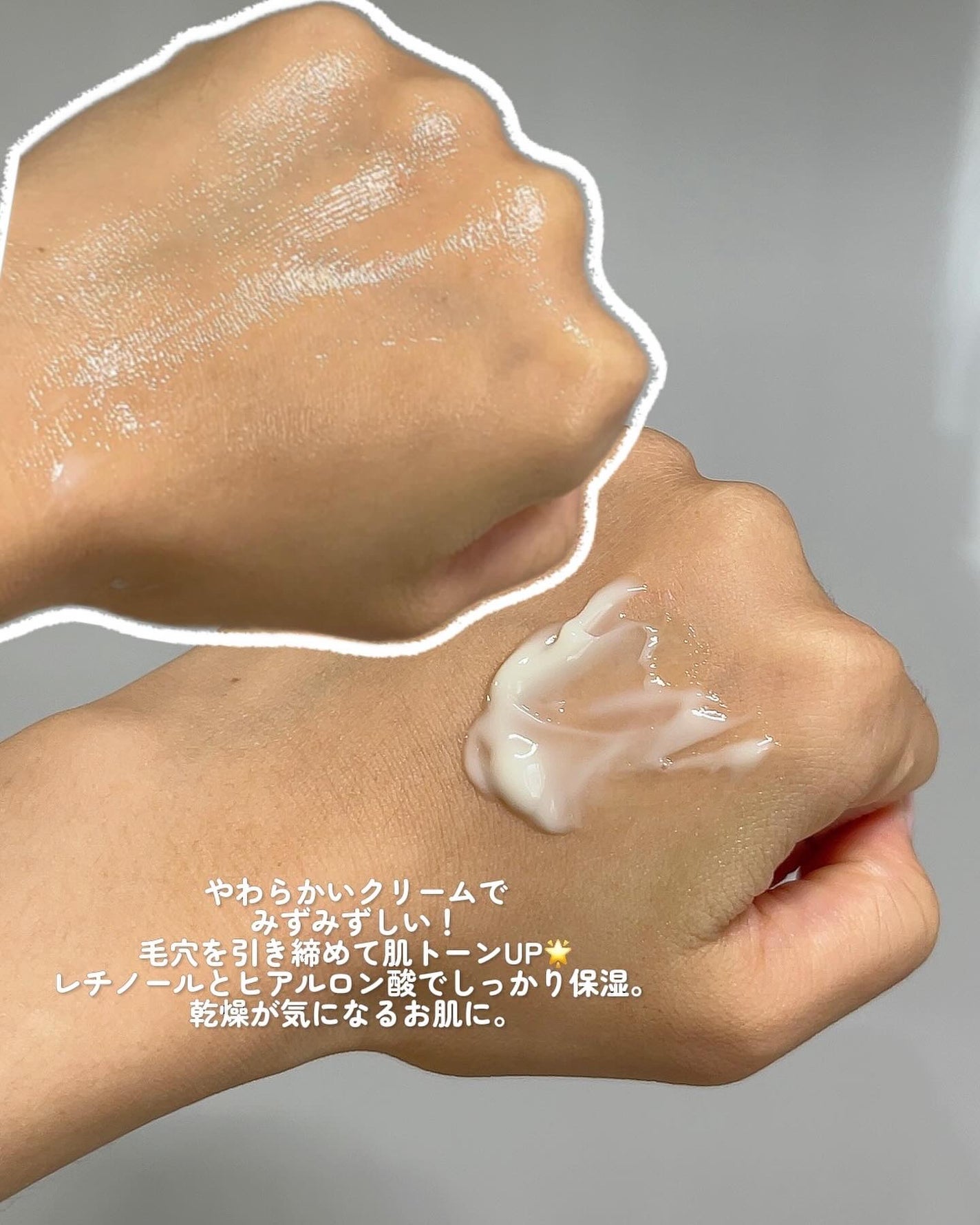 レチノール0.1クリーム/APLIN/フェイスクリームを使ったクチコミ(2枚目)