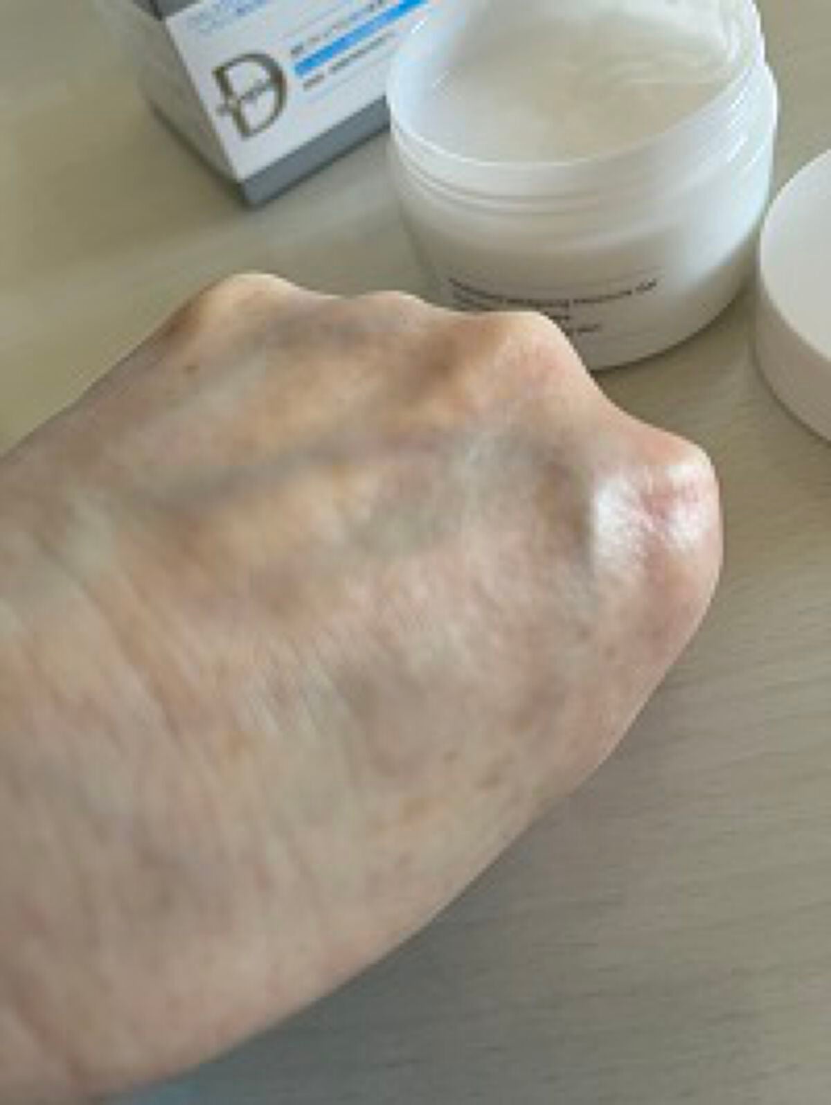 薬用アトピアD 美白保湿ミルクゲル/アトピアD/オールインワン化粧品を使ったクチコミ(4枚目)