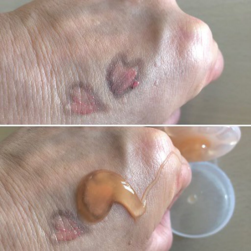 ホットクレンジングジェル/ベジスキン/クレンジングジェルを使ったクチコミ（2枚目）