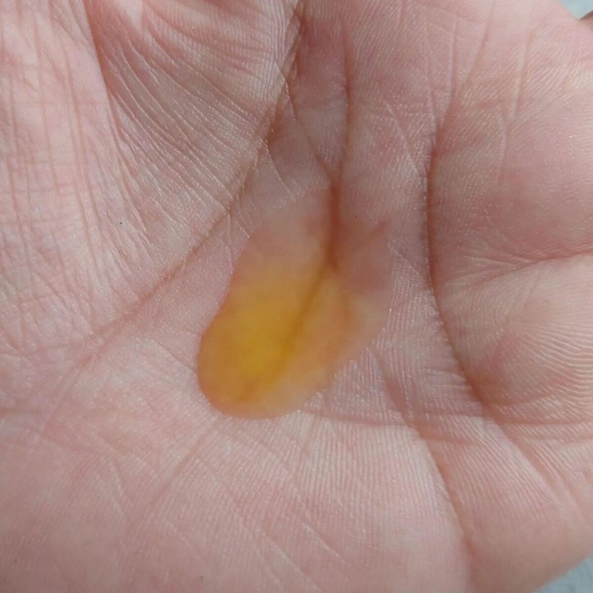 ミシャ ビタシープラス 美容液【日本処方】/MISSHA/美容液を使ったクチコミ（3枚目）