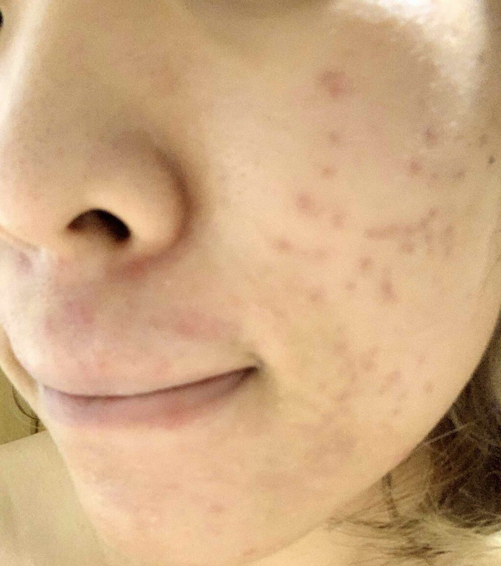 ゼロ毛穴パッド/MEDICUBE/ブースター・導入液を使ったクチコミ（3枚目）