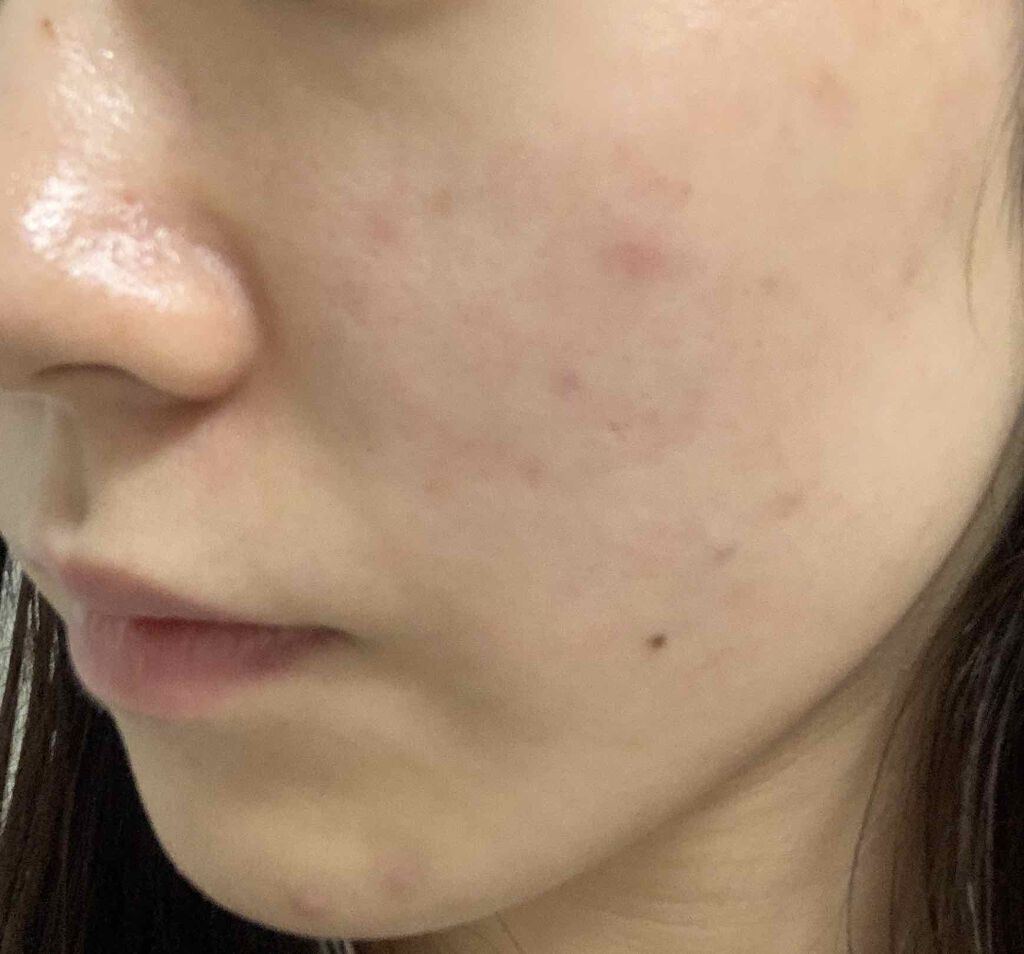 クリアトライアルセット M(しっとりタイプ)/オルビス/トライアルキットを使ったクチコミ(3枚目)