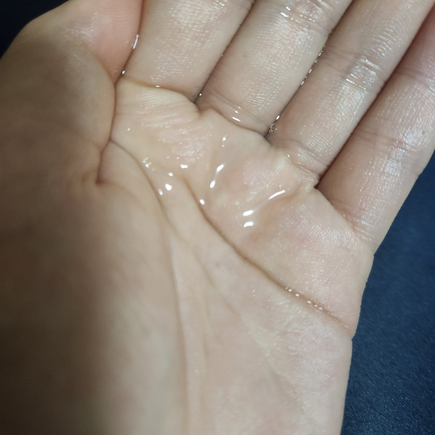 モイストケア ローション MB/d プログラム/化粧水を使ったクチコミ(5枚目)