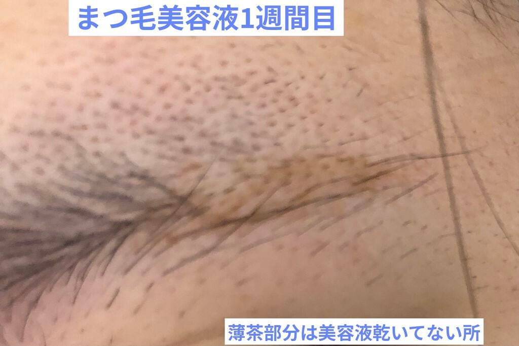 スカルプD ボーテ ピュアフリーアイブロウセラム/アンファー(スカルプD)/その他アイブロウを使ったクチコミ(4枚目)