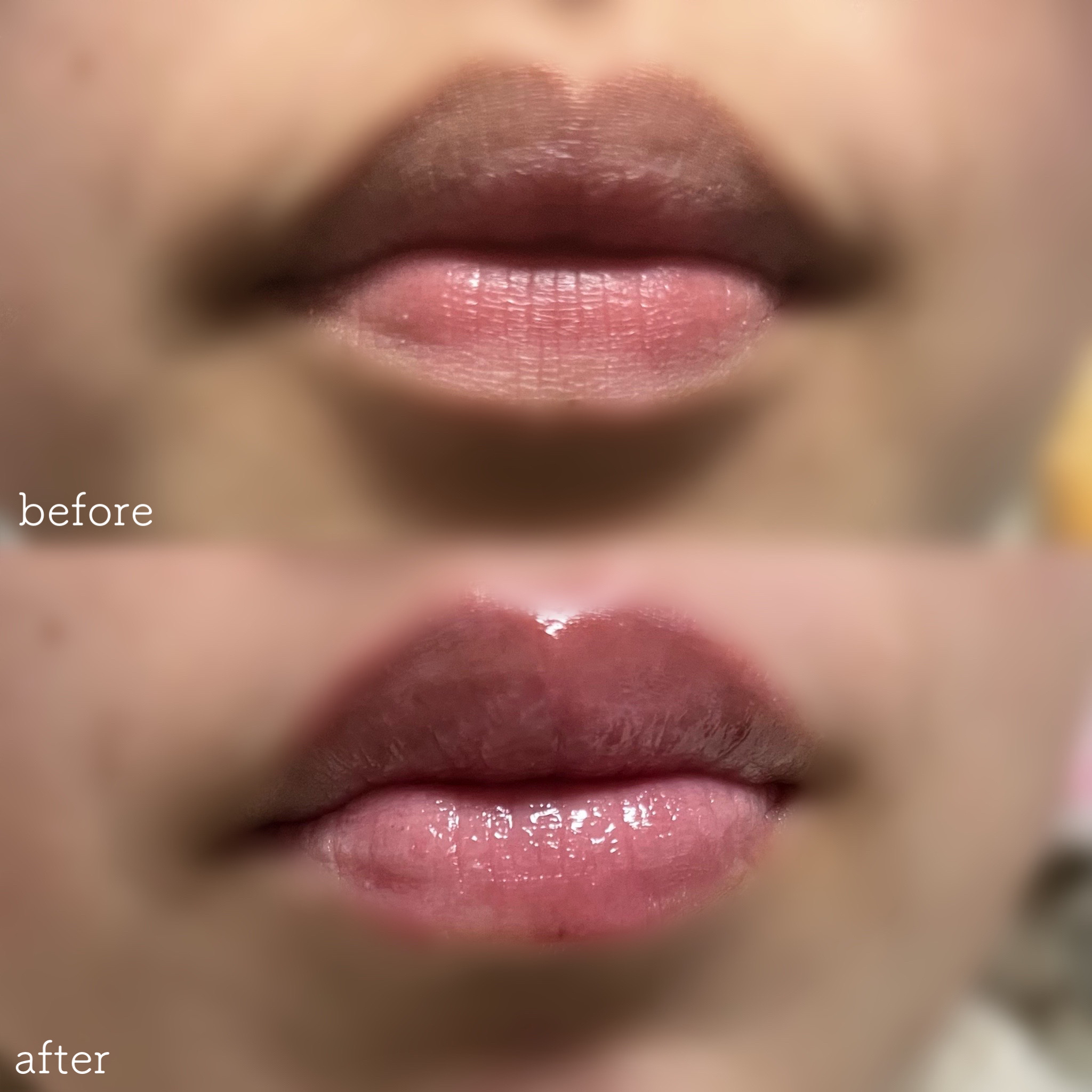 ボリュームリッププランパー/BANILA CO/リッププランパーを使ったクチコミ（2枚目）