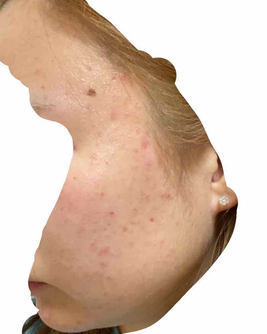 り on LIPS 「だんだん減ってきました!まだまだ頑張ります!..」(3枚目)