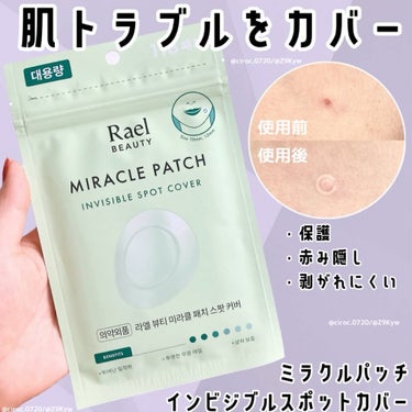 Rael ビューティーミラクルパッチスポットカバーのクチコミ「#PR #ラエル

ミラクルパッチ インビジブル スポットカバー
（10mm × 35個 ×2.....」（1枚目）