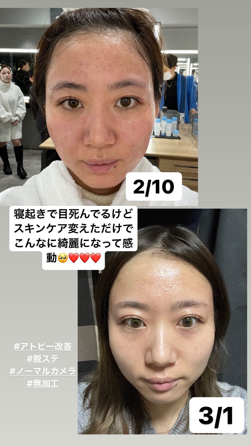 を使ったクチコミ（1枚目）