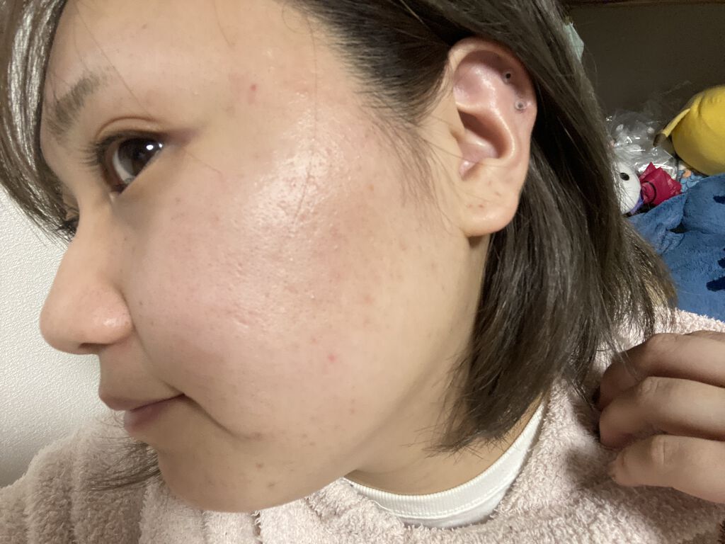 マデカソ CICAクリーム  /A’pieu/フェイスクリームを使ったクチコミ（1枚目）