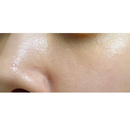 メディプローラー CO2ジェルマスク/ドクターメディオン/洗い流すパック・マスクを使ったクチコミ(7枚目)