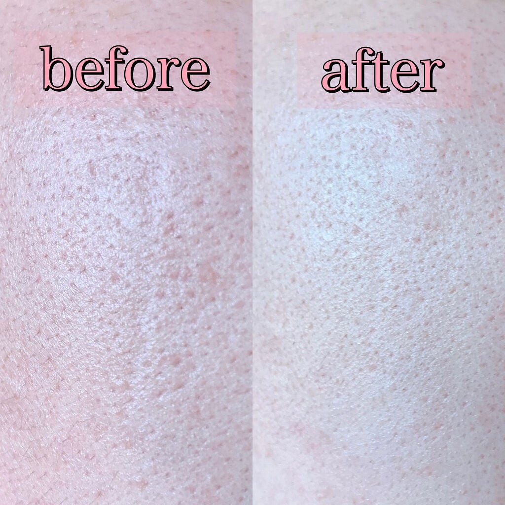 ピンクティーツリークリーム/APLIN/フェイスクリームを使ったクチコミ(9枚目)