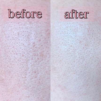 ピンクティーツリークリーム/APLIN/フェイスクリームを使ったクチコミ(9枚目)