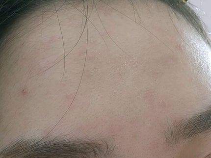 イプノス シーバムクリア リペアクリーム/ACSEINE/フェイスクリームを使ったクチコミ(6枚目)