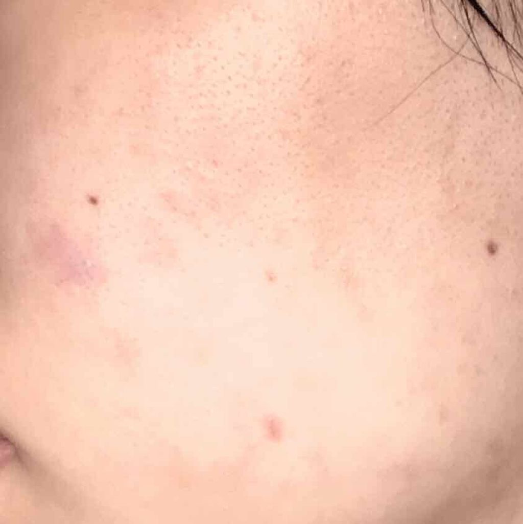 DHC ビタミンCハードカプセル/DHC/美容サプリメントを使ったクチコミ(2枚目)