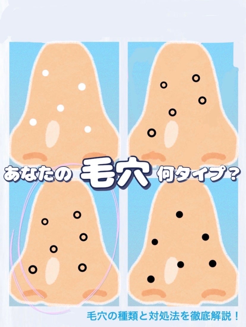 CocoNa/フォロバ100% on LIPS 「 \〜あなたの毛穴は何タイプ?〜/ 毛穴の種類..」(1枚目)