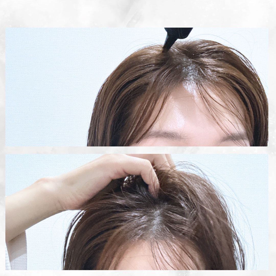 ナノグロウリッチ/iqumore/頭皮ローションを使ったクチコミ（3枚目）