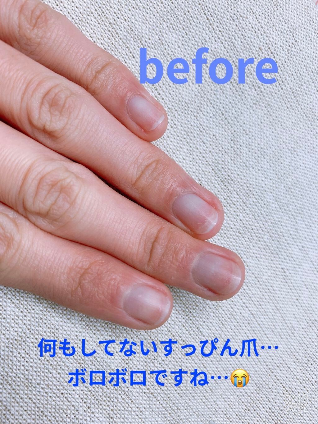 ãã£ãŒã¢ãããã¡ã³ããŒã·ã§ã³/D-UP/ãã€ã«ããŒã¹ã³ãŒãã䜿ã£ãã¯ãã³ãïŒ2æç®ïŒ