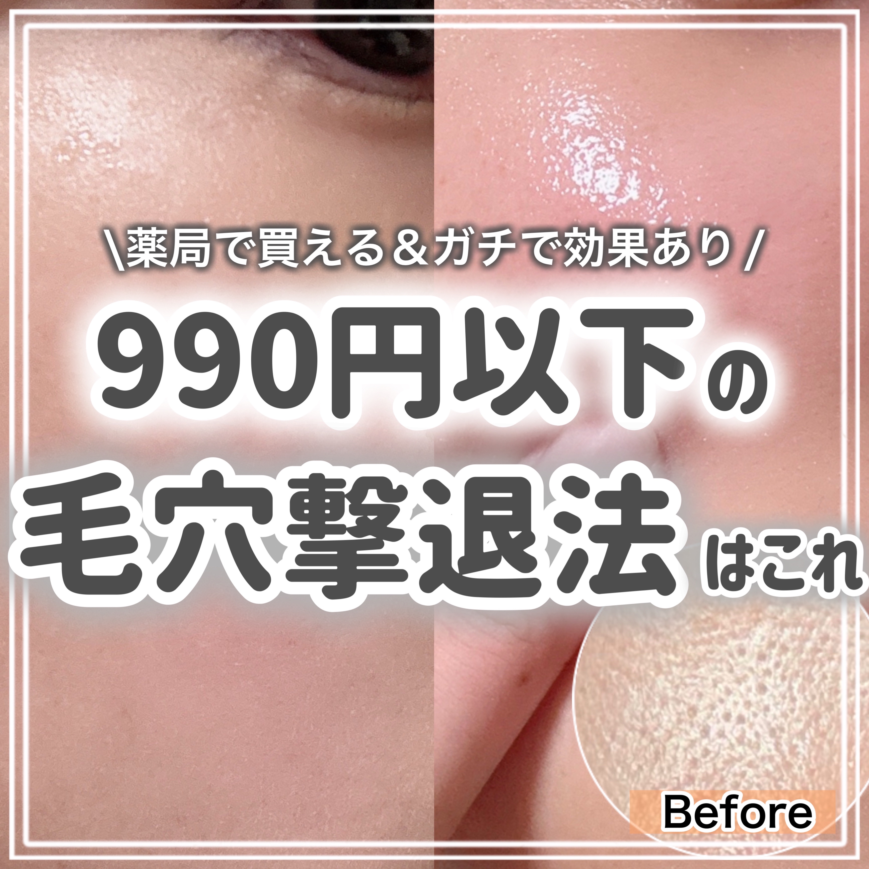 リードルショットEX コラーゲンモデリングパック/VT/シートマスク・パックを使ったクチコミ（1枚目）