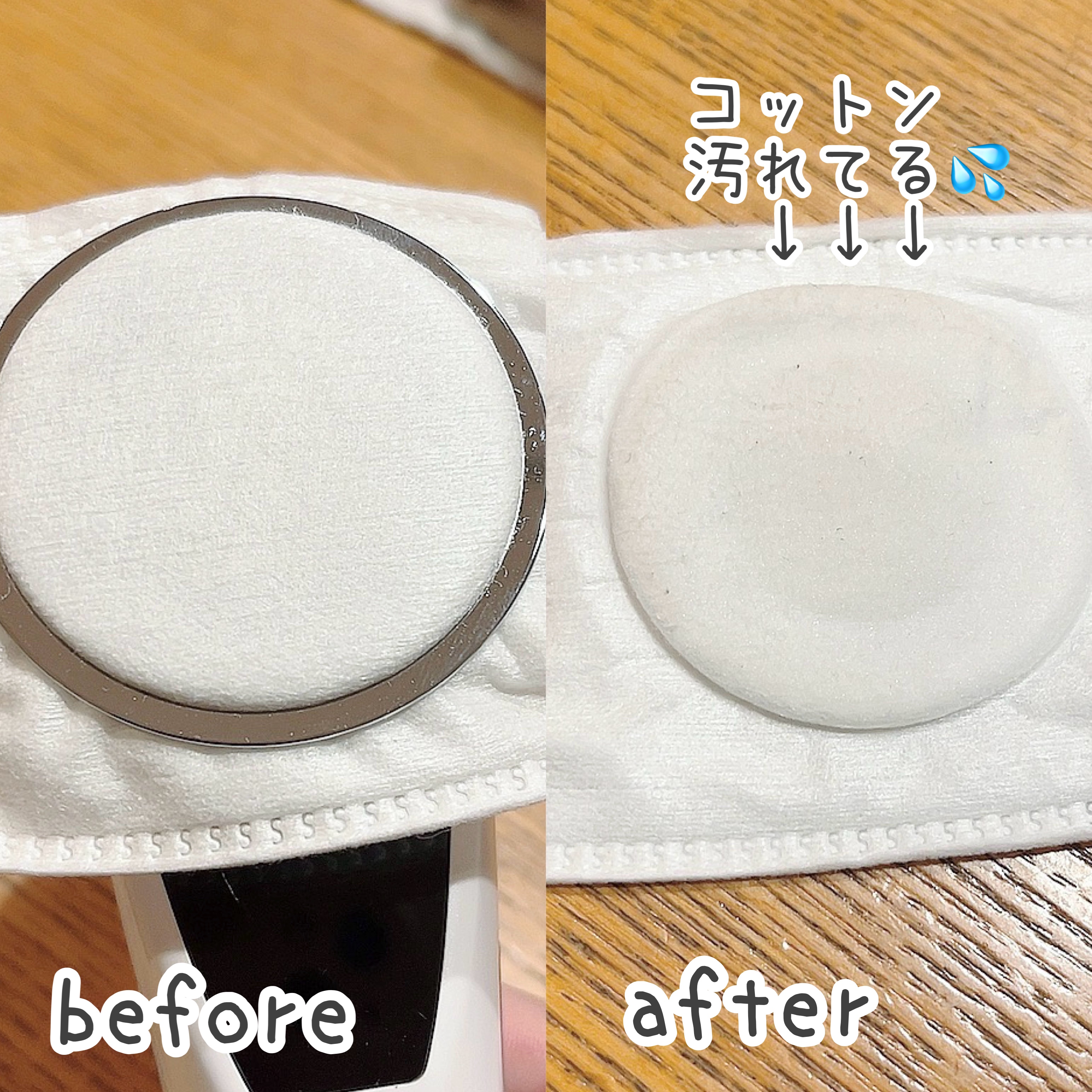 多機能温冷美顔器/ANLAN/美顔器・マッサージを使ったクチコミ（3枚目）