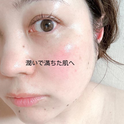 ローション/イオナ エフ/化粧水を使ったクチコミ(9枚目)