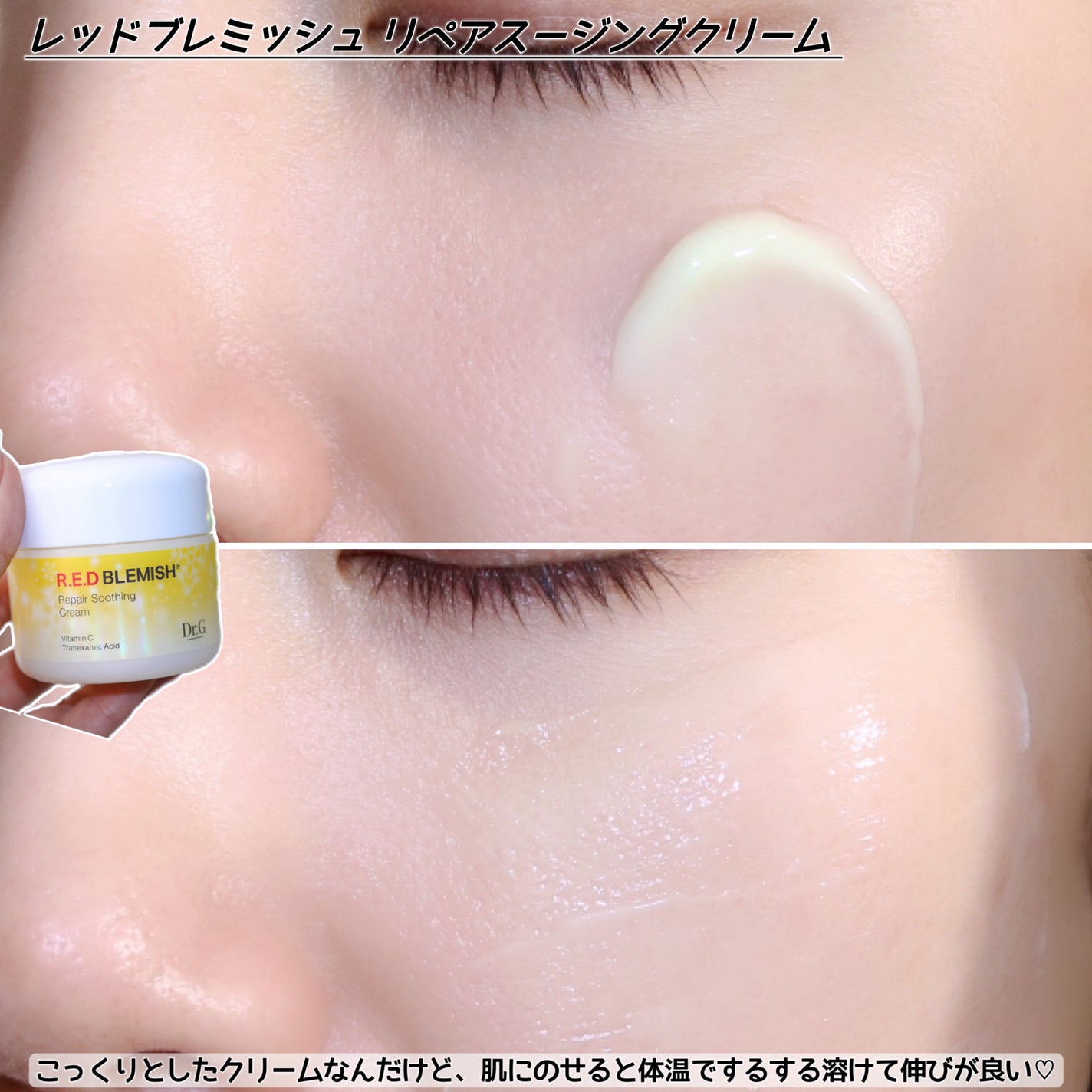 レッドブレミッシュ リペアスージングクリーム/Dr.G/フェイスクリームを使ったクチコミ(5枚目)